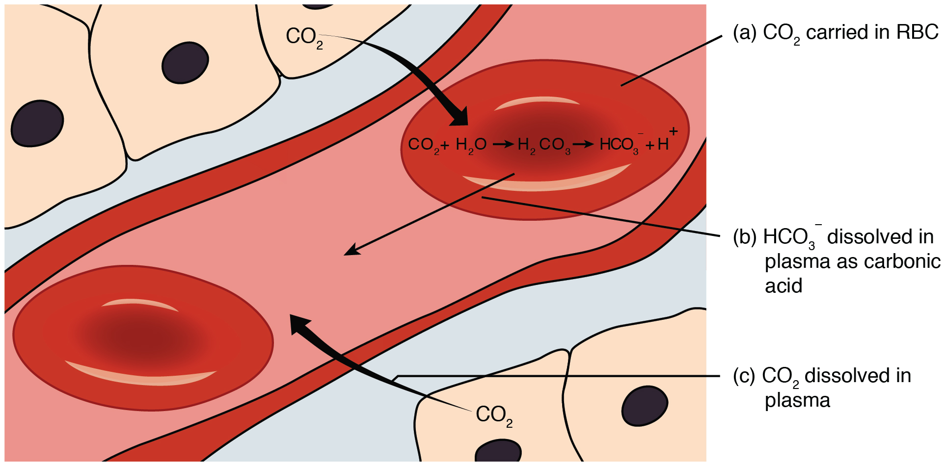 Carbon material in blood.